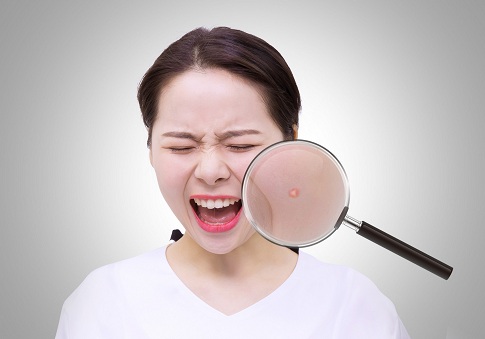 1643213799922147.jpg 摄图网_500800547_banner_长痘美女(企业商用).jpg