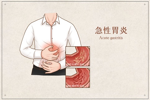 摄图网_401789692_banner_急性胃炎医疗插画（企业商用）.jpg