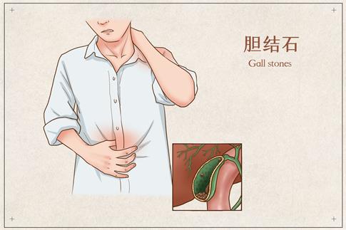 1674084600442630.jpg 摄图网_401804065_banner_胆结石医疗插画(非企业商用).jpg