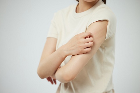 神经性皮炎易发生在颈部两侧和四肢伸侧,中年人是高发人群.