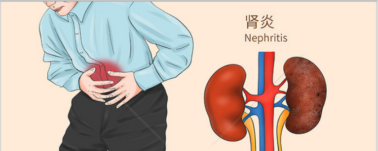 6个表现说明进入慢性肾炎阶段快对照着看一看