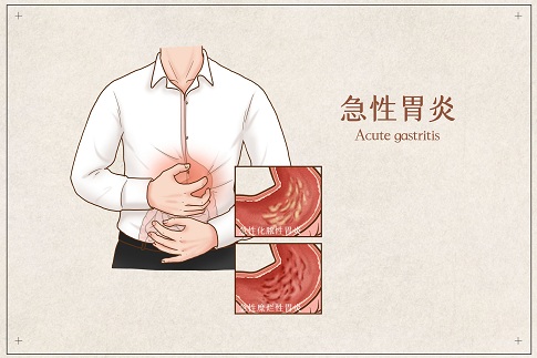 1656689842525012.jpg 摄图网_401789692_banner_急性胃炎医疗插画(企业商用).jpg