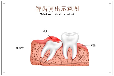 1659282417578019.jpg 摄图网_401803631_智齿萌出示意图(企业商用).jpg