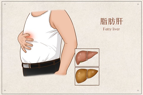 1660495638410305.jpg 摄图网_401804062_脂肪肝医疗插画(企业商用).jpg