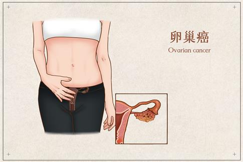 1682494196777748.jpg 摄图网_401800159_banner_卵巢癌医疗插画(企业商用).jpg