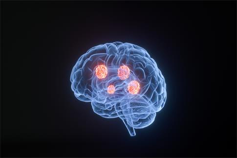 1693526613362250.jpg 摄图网_401808392_banner_3D疾病脑癌场景(企业商用).jpg