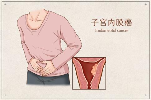 1693784407646926.jpg 摄图网_401866465_banner_子宫内膜癌医疗插画(企业商用).jpg