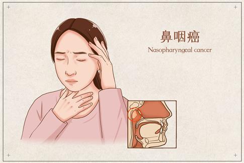 1694135439533600.jpg 摄图网_401866466_banner_鼻咽癌医疗插画(企业商用).jpg