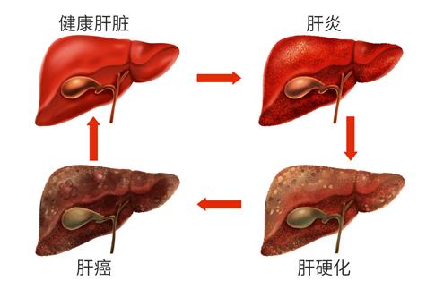 1718236176135802.jpg 摄图网_401806707_banner_乙肝肝脏病变症状医疗插画(企业商用).jpg