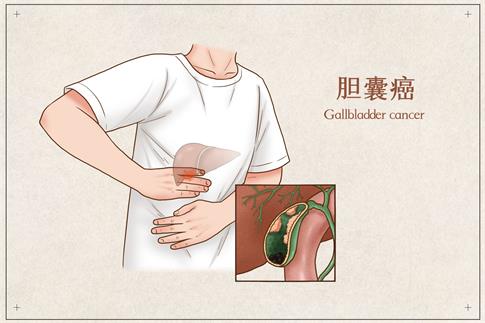 1728604499252477.jpg 摄图网_401794948_胆囊癌医疗插画(非企业商用).jpg
