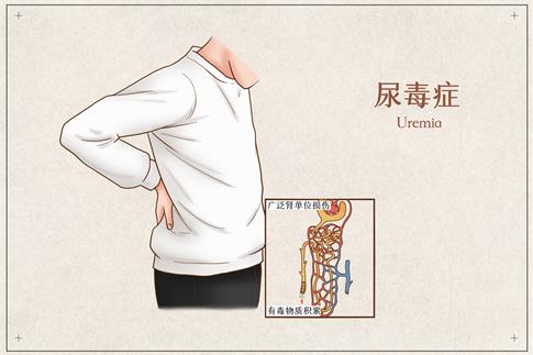 1735344624431938.jpg 摄图网_401794004_尿毒症医疗插画(企业商用).jpg