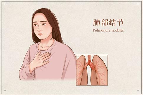 1738973377843258.jpg 摄图网_401863170_banner_肺部结节医疗插画(企业商用).jpg