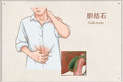 1749775080407166.jpeg 修改尺寸 (2).jpeg